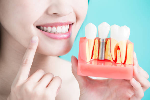 The Benefits of Invisalign Over Metal Braces